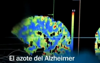 el azote del alzheimer